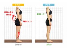 ライカム鍼灸整骨院/プロによる骨盤バランス調整
