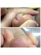 nail salon Cyan & Dr.ネイル【11/1 NEW OPEN(予定)】の写真/【足元のお悩み解消】巻き爪・角質・魚の目も徹底ケア★歴8年の専門知識で老若男女問わず健康的な素足へ♪