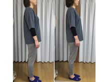 スマイル(smile)/befor after 