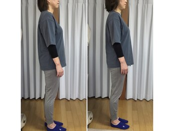 スマイル(smile)/befor after 