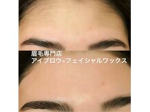 スノー(S.now)の雰囲気（マリムーブによる脱毛・フェイシャルエステ）