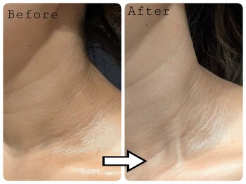 トリニティスペース(TrinitySpace)/美白カクテル×プラズマ