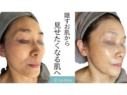 ラリマ(La-lima)の写真