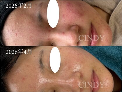 シンディー(CINDY)の写真