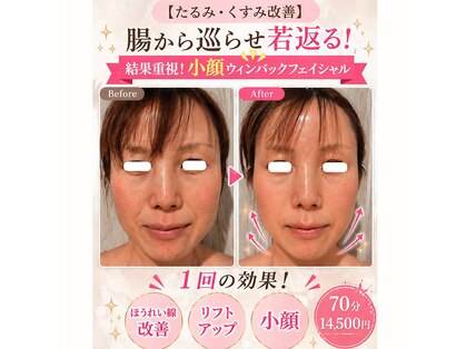 エステル 東口本店(esther)の写真