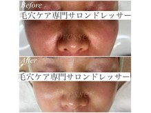 ドレッサー(Dresser)の雰囲気(40代急な赤ら顔も丁寧なケアを施す事で健康な肌を再び取り戻す)