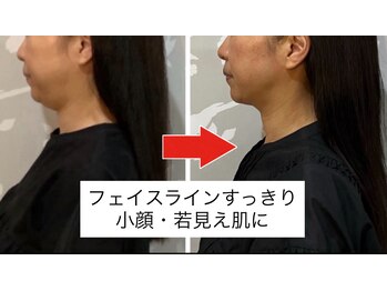 カラット(CARAT)の写真/今話題&人気の【韓国発レッドショット】導入!!天然由来成分で脂肪ケアし分解◎導入機器でしっかり体に浸透!