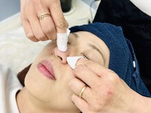 ポツポツのいちご鼻に毛穴洗浄！角栓を根元から押し出します！