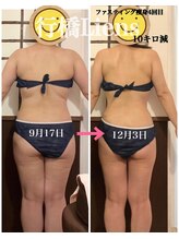 リアン(Liens)/Liens痩身