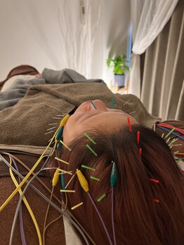 ハリキュア(Hari-Cure)/美容鍼と疲頭鍼