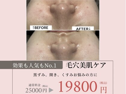 エンチャント(ENCHANT)の写真