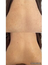 リラ(Lilas)/1度の変化