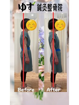 ゆず鍼灸整骨院/姿勢が変わると、心も軽くなる