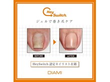 エール(Ailes)の雰囲気（巻き爪でお困りの方に！ジェルしながら巻き爪ケアできます。）