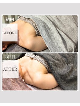 エナボン 上野(ENABON)/立体バストと美しいデコルテ形成