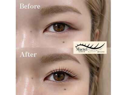 ミリ 吉祥寺店(mili)の写真