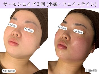 ラエッセ(La Esse)/みんなに痩せた？と言われる