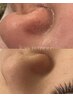 【毛穴特化☆毛穴レス＆黒ずみ】金の糸脱毛しっかり×水素水ハイドロ毛穴洗浄