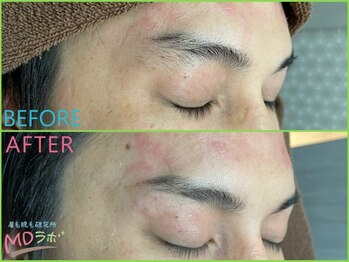 エムディラボ 富山新根塚店(MDラボ)/before after