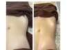 【大人気！】次世代腸揉み×二の腕ほっそり＆肩こり撃退(肩甲骨周り)9800