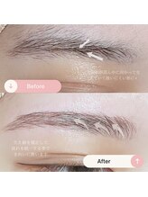 シャルトルズ 広島八丁堀店/症例写真３