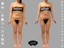 ソウソウビューティー 五反田(Shou Shou Beauty)/ビフォー★アフター