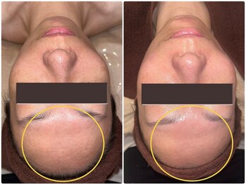 エルマナ(Hermana)/