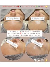 クレヴィー(Creviy)/3セットコース