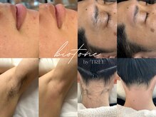 ビオトーン バイ ツリー(biotone by TREE)の雰囲気（各種お仕上がり/ワックス脱毛/アロマトリートメント）