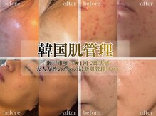サロンアズ(salon AZU)