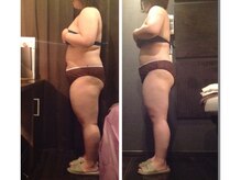 プラチナアース 守谷店(Platinum earth)/痩身ビフォーアフター