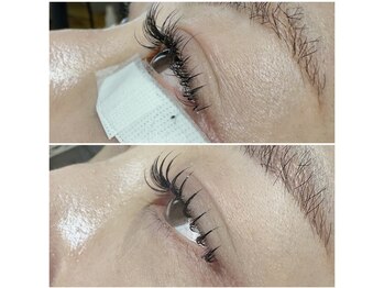 アンレーヴ(Un Reve)/&healthy(アンドヘルシー)100本