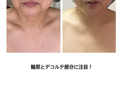 パールブリス(Pearlbliss)の写真