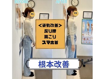 心斎橋長堀フェムテック整骨院の写真/【スマホ首/肩こり/顎関節の姿勢矯正整体60分¥4280】今すぐどうにかしたい首肩コリ/頭痛/眼精疲労に◎