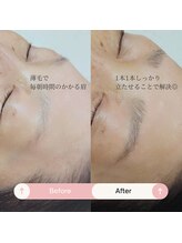 シャルトルズ 広島八丁堀店/症例写真４