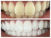 ホワイトニングショップ 山科店