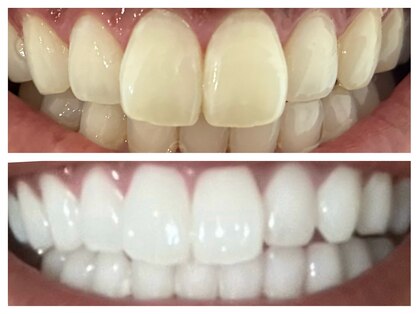 ホワイトニングショップ 山科店の写真