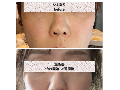 サロン リノ(salon rino)の写真