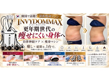 ビジュー(Bijoux)の写真