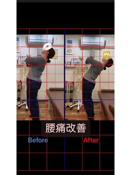 ヒデ整体院(Hide整体院)/慢性腰痛改善骨盤矯正コース