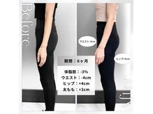 リフ(RIF)の雰囲気（体脂肪－4％ / ウエスト－4cm / ヒップ＋4cm）