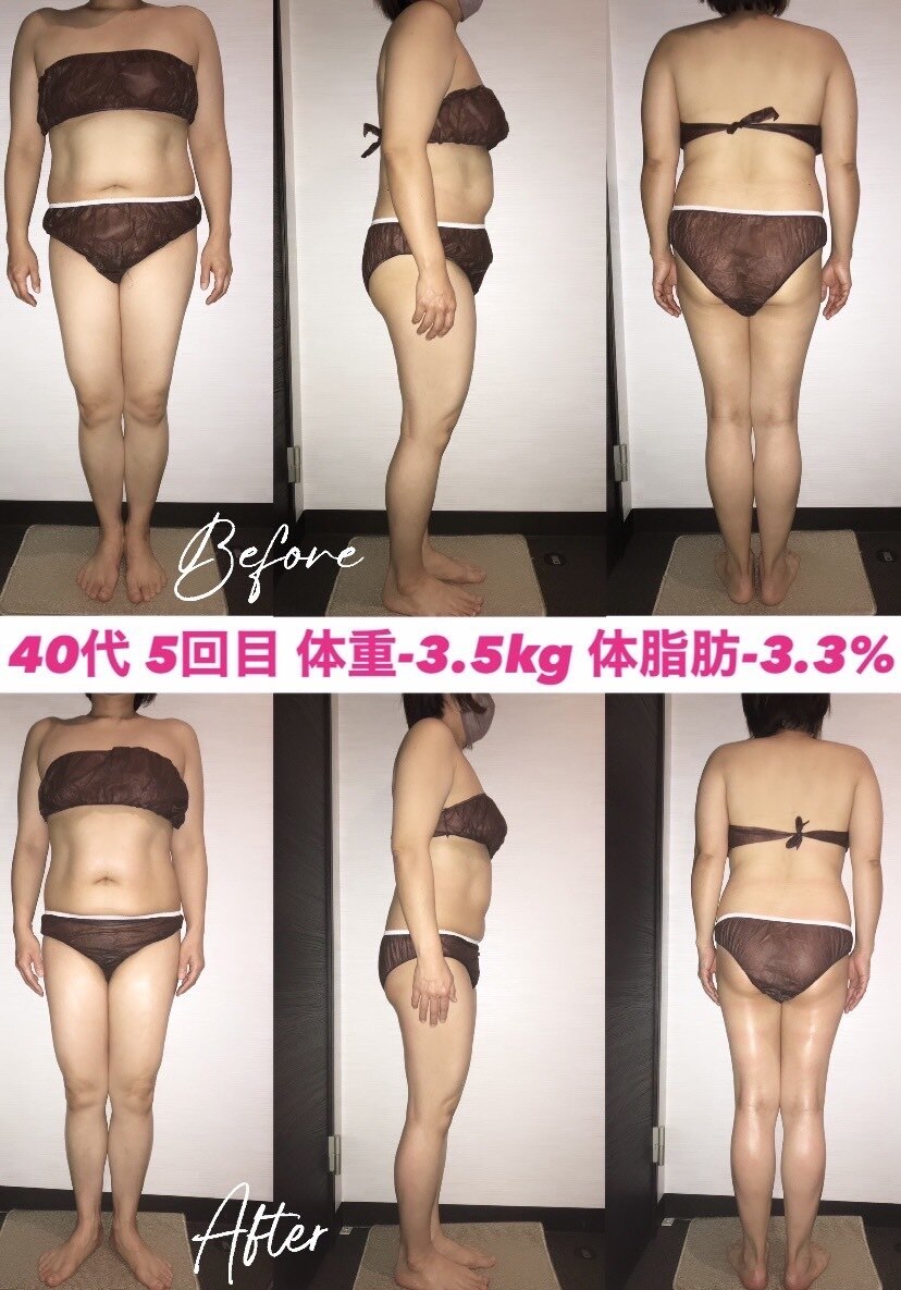 シェイプリフト　定価約30万　美容　痩身　ダイエット シェイプリフト 定価約30万 美容 痩身 ダイエット