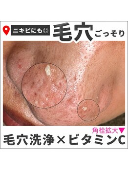 ユズドット(yuzu.)の写真/【毛穴悩みに本当に必要なケアできていますか?】