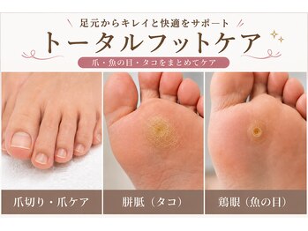 イルミナ(illumina)の写真/【口コミ4.9★】厚い爪・切りにくい爪・魚の目・タコをケア！
