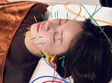 フラット(flat)の雰囲気（【電気を流す小顔美容鍼】小顔・むくみ/肌質改善・ニキビケア◎）