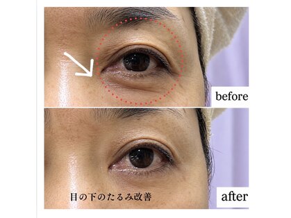シュシュ(chouchou)の写真