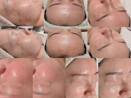 オンド(OND)の写真