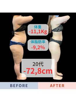 エステティック エイチアンドビー 大和店(H&B)/ビフォーアフター