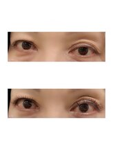 ナチュレ 武蔵浦和店(NATURE)/フラットラッシュ140本