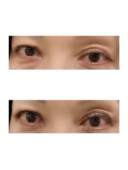 ナチュレ 武蔵浦和店(NATURE)/フラットラッシュ140本